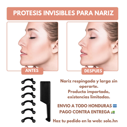 Nose Lifters – Kit Invisible de Levantamiento Nasal